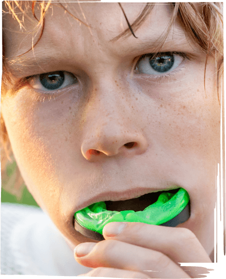 Boy putting a green mouthguard into his mouth