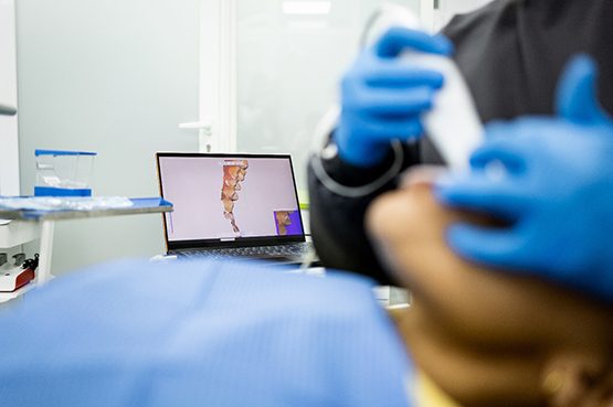 a patient during dental impressions
